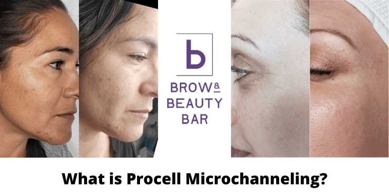 what is procell microchanneling